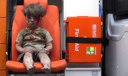Окървавено дете ли? Асад вижда само манипулация!