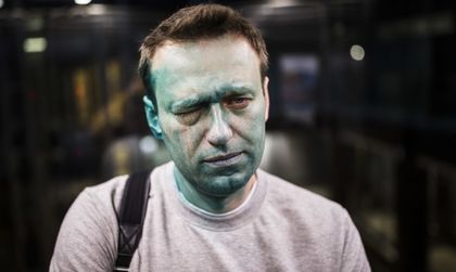 Опозиционер зад граница: Навални опериран в Испания