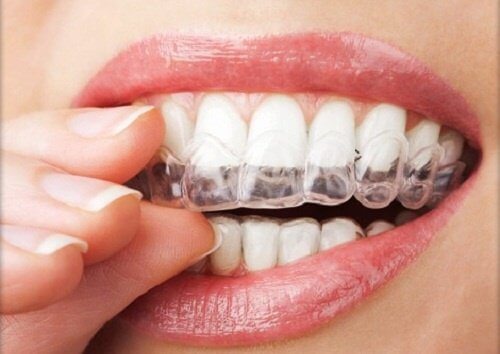 Какво трябва да знаем за скърцането със зъби