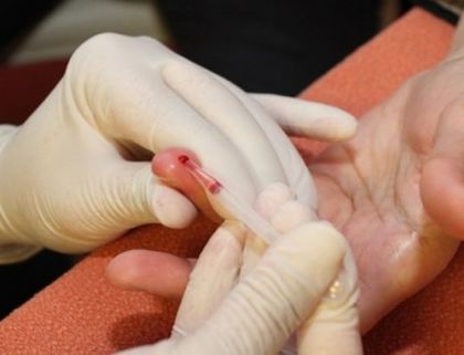110 хиляди българи поразени от тихия убиец