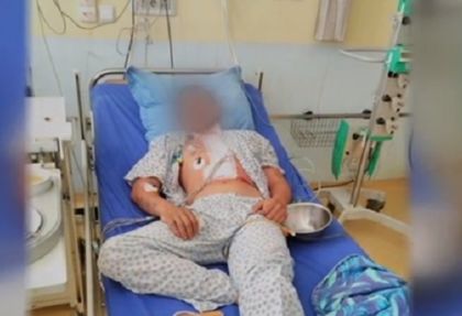 Ето как са спасили наръган с нож младеж, постъпил в болница с три литра кръв в дробовете (СНИМКА)