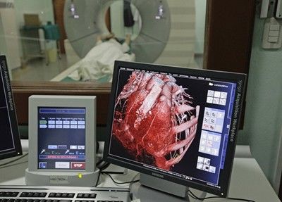 При сърдечна болка над 15 минути търсете лекар - може да е инфаркт