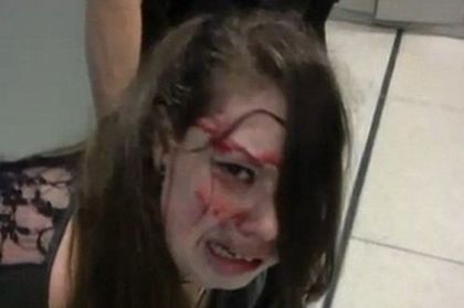 Шокиращи кадри! Охранители пребиха сляпо момиче след операция на мозъчен тумор (ВИДЕО)