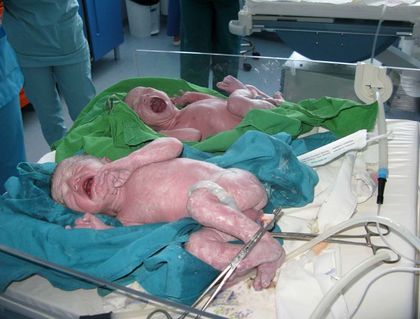 ТАСС: Жена роди шест деца в Полша
