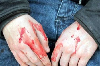 Деветокласник отнесе зверски бой заради ябълка