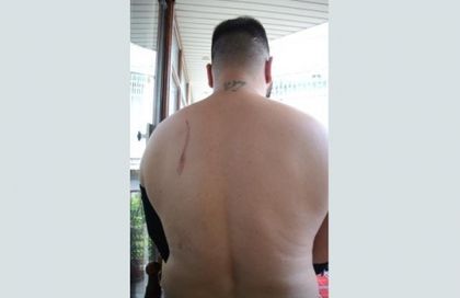 Ново ромско безчинство! От рода Кетовци пребиха двама братя с колове и камъни (СНИМКИ 18+)