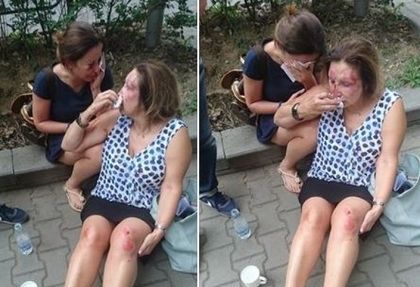 Съмнително: Пребитата в Борисовата градина Валентина не дава да проверят работата й като нотариус