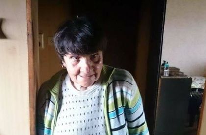 Ужасът в Пловдив: Баба Благодатка едва оцеля от огнен ад
