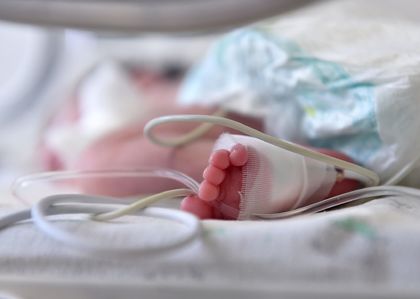 Шепичка живот! 500-грамово бебенце в Пловдив се бори мъжки да оцелее