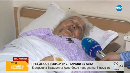 Зверски пребитата жена от Гурково разказва за ужаса от преживяното (ВИДЕО)