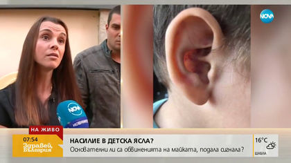 НАСИЛИЕ В ЯСЛА?: Родители взеха детето си с хематом на ухото
