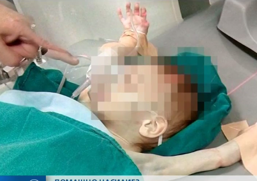 ДОМАШНО НАСИЛИЕ? Близначета са в болница в Пловдив с кръвоизливи (ВИДЕО)