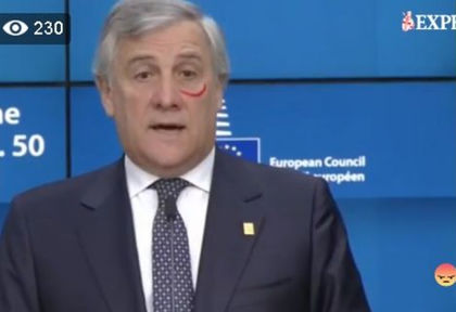 Босът на Европарламента втрещи с вида си! Всички се чудят какво е това ВИДЕО