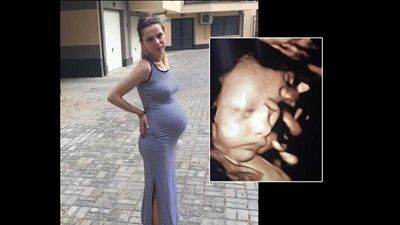 Съпругата на национала Радослав Димитров - Виктория: Доктор ми уби бебето!
