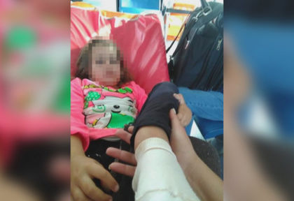 7-годишно дете пострада тежко в училище в Годеч, но никой не знае точно как