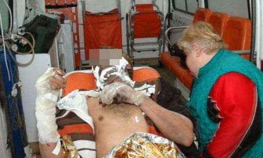 Работник от ВМЗ-Сопот падна във вана с основа! Борят се за живота му