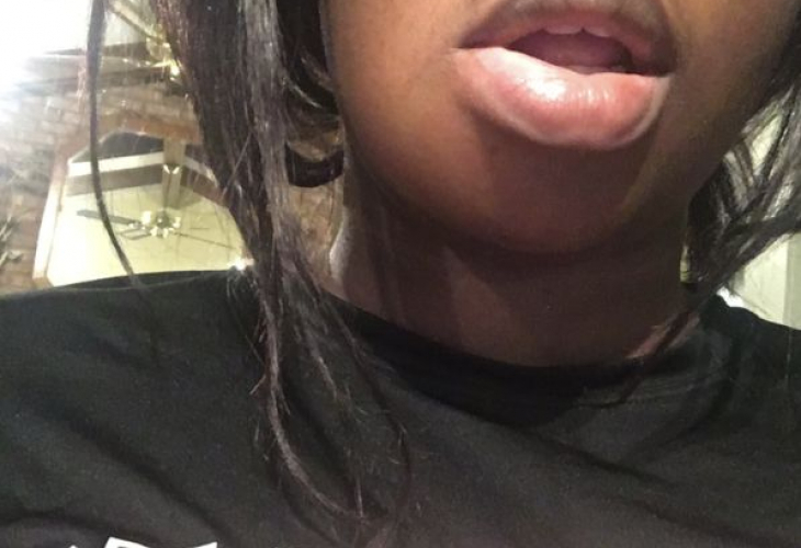 Млада американка показа подутите си устни и стана сензация в мрежата (СНИМКИ/ВИДЕО)