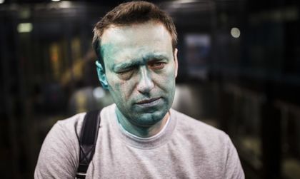 Навални загубил 80% от зрението си на едното око