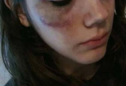 КРЪВ НА АВТОГАРАТА! Бандити пребиха жестоко младо момиче пред очите на стотици хора