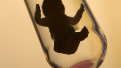 Всяка четвърта ин витро процедура, финансирана от държавата, е успешна
