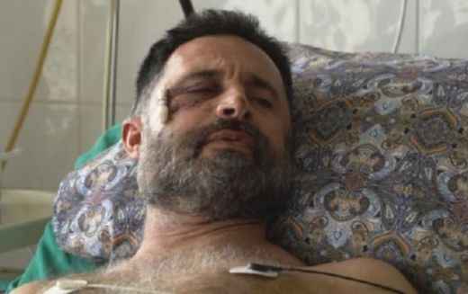 Пребитият фермер от Видинско: Раната от бездушието на полицията няма да зарасне