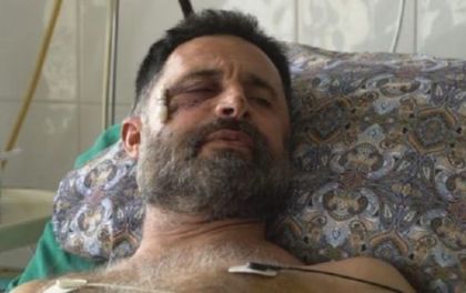 Пребитият фермер от Видинско: Раната от бездушието на полицията няма да зарасне