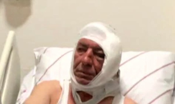 Пребиха жестоко журналист, критикувал Ердоган
