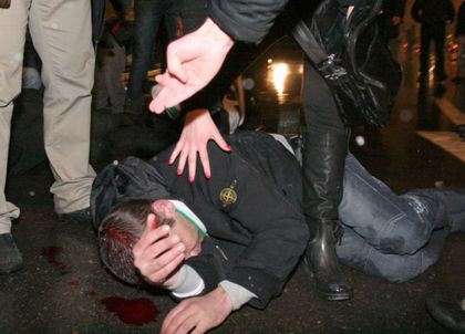 Жена и още двама млатят 29-годишен в дома му