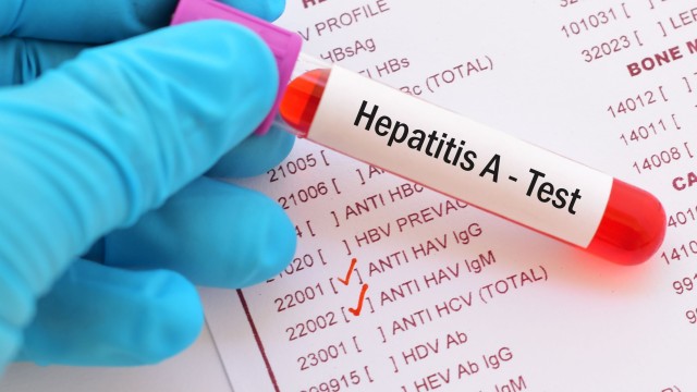 Започва кампания за тестове за хепатит и ХИВ в Капана