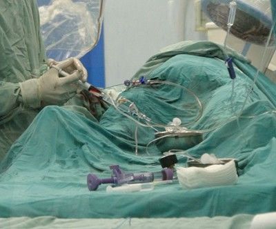Светила от Франция оперират в Пловдив деца с тежки аномалии